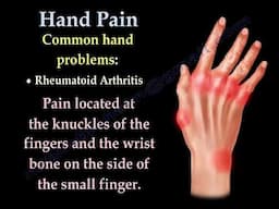 Hand and Finger Pain: Common Causes and Symptoms Explained