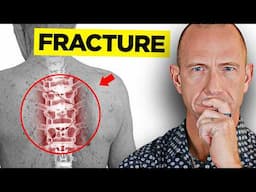 How This Patient Reversed Osteoporosis Naturally (Patient Success Story)