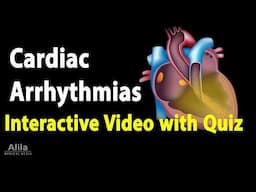 NEW: INTERACTIVE Animation with Quiz: Cardiac Arrhythmias