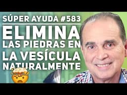 SÚPER AYUDA #583 Elimina Las Piedras En La Vesícula Naturalmente