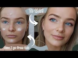 MY SKIN AFTER ACCUTANE! HOW I COVER MY SCARRING