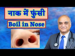 नाक में दाना। Boil Nose। Dr Rajive Bhatia। Hindi