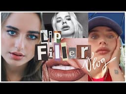 ur lip filler may be botched but mine isn't (anymore) lol | los angeles daily vlog