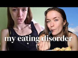 MY 6 YEAR EATING DISORDER RECOVERY STORY | Anorexia and Orthorexia Journey