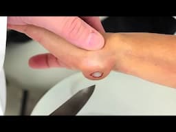 Man Has Weird Round Spots On Wrist When The Doctor Sees It He Called The Cops