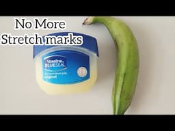 Say Goodbye to STRETCH MARKS | Stretch Marks Fader