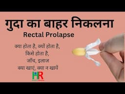 Rectal prolapse || रेक्टल प्रोलैप्स क्या है, रेक्टल प्रोलैप्स का मुख्य कारण क्या है,