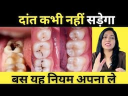 दांतों में सड़न और कीड़े कभी नहीं लगेंगे बस ये घरेलु तरीकेअपनाये | How To Prevent  Tooth Decay  |