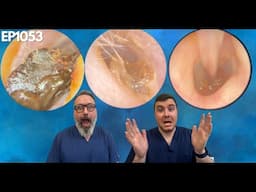 SO MANY EAR WAX REMOVALS! - EP1053