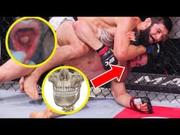 Robert Whittaker's Jaw Crushed by Khamzat Chimaev in UFC 308 | Anatomy Explained