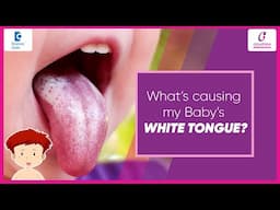 WHITE TONGUE in Baby | Pinching NIPPLE PAIN in Mother| Oral Thrush-Dr.Sukhpreet Kaur|Doctors' Circle