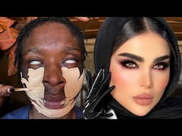 A Blind Girl Got Transformed Into This 😳👆🔥Unbelievable Makeup Transformation 🔥💉😳🔥😱 Makeup Tutorial