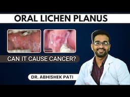 ORAL LICHEN PLANUS- CAN IT CAUSE CANCER?