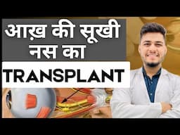 आख़ की सूखी नस का Transplant | Full Optic nerve Transplant.