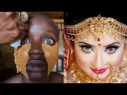 Black Girl Got Transformed Into Indian Bride 😱😳🔥 Makeup Transformation 💉 Cirurgia Plastica 😳✂️