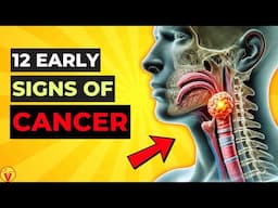 12 Warning Signs of CANCER Growing In Your Body You Shouldn't Ignore (Never Miss) | VisitJoy