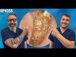 Patient Got Their Ear Wax Removed After 10 Years - EP1055