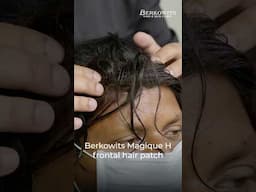 Berkowits Magique H Frontal Hair Patch