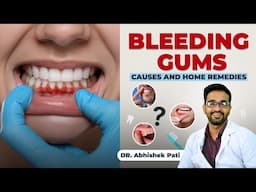 BLEEDING GUMS - CAUSES AND REMEDIES| मसूड़ों से खून निकलने का घरेलू उपचार